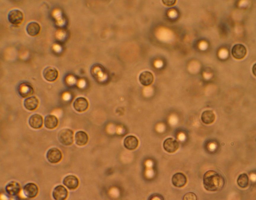 Urinary Tract Infection in Children